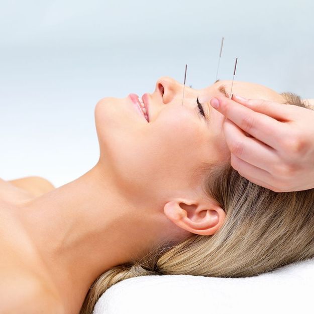 lifting par acupuncture medecineschinoises.fr