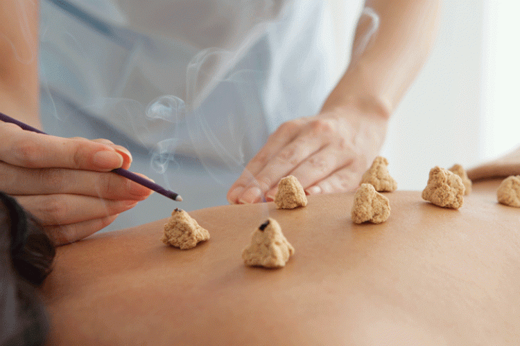 moxibustion medecineschinoises.fr