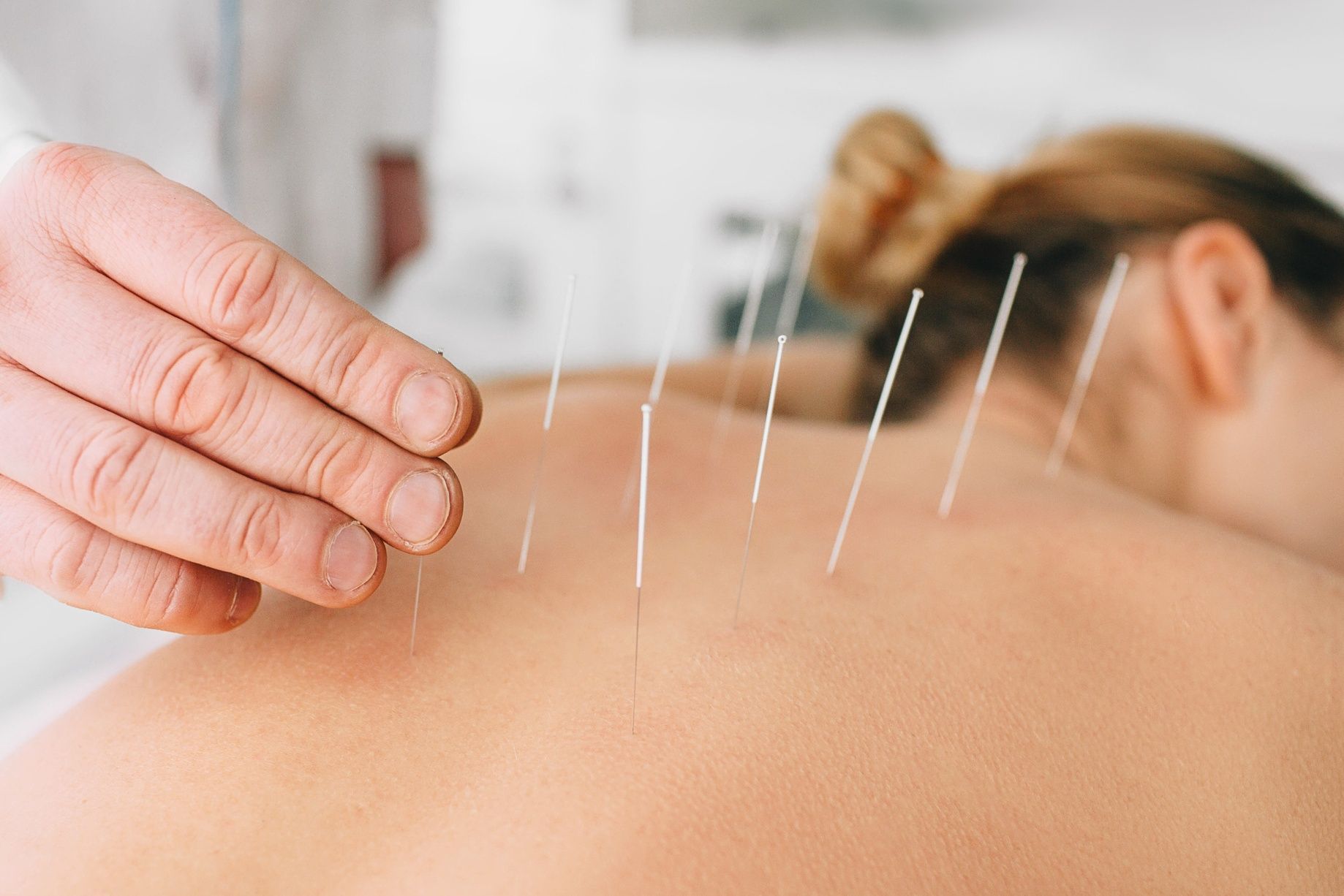 acupuncture medecineschinoises.fr